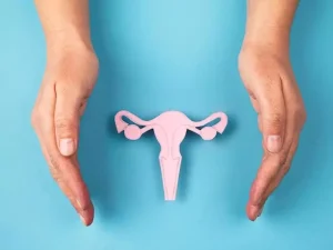 درمان کیست تخمدان در سنندج