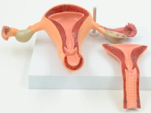 فریز کردن دهانه رحم