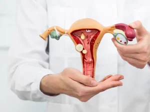 درمان پولیپ رحم